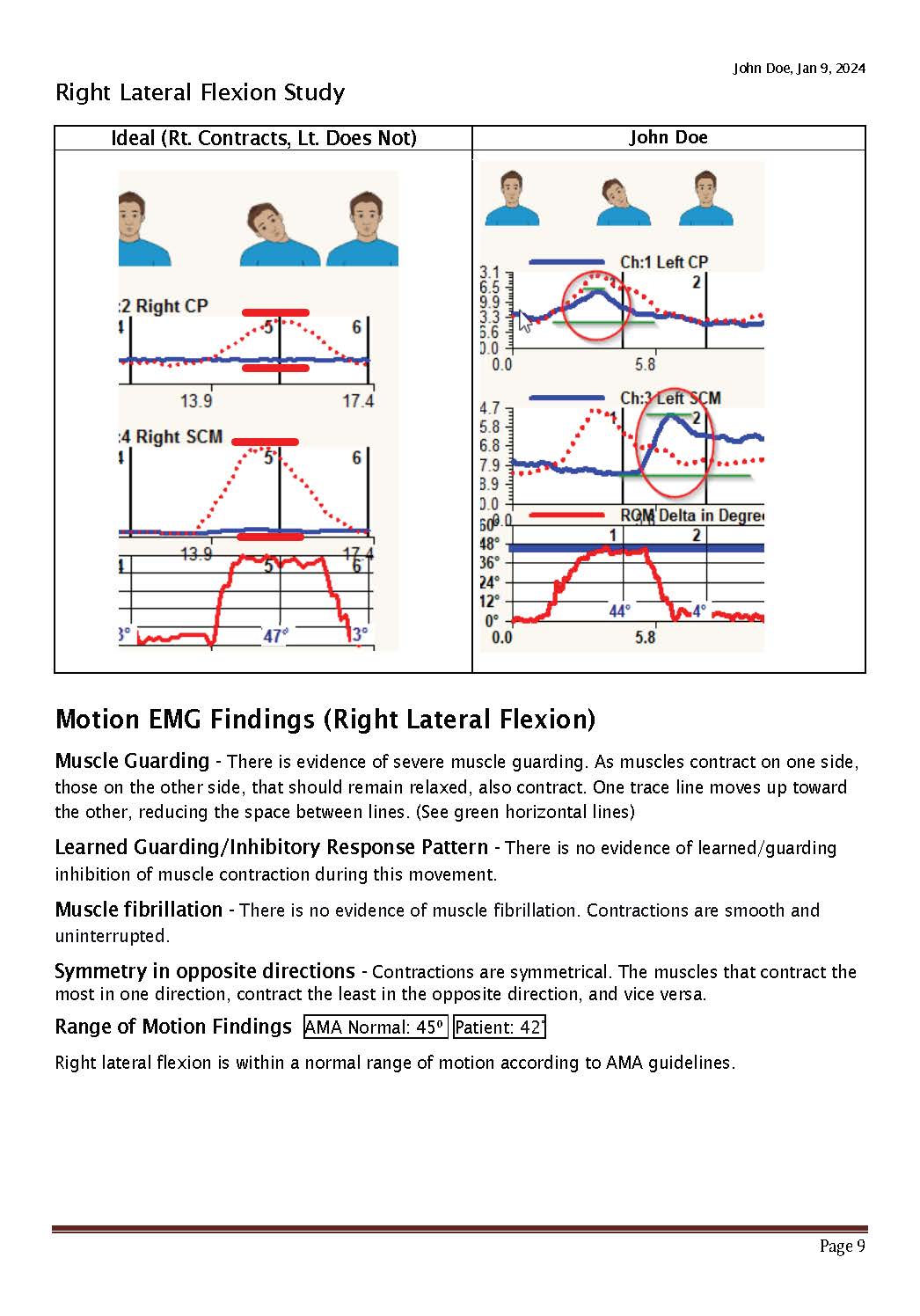 Sample Cervical Dynarom ROM EMG 11-2024_Page_09