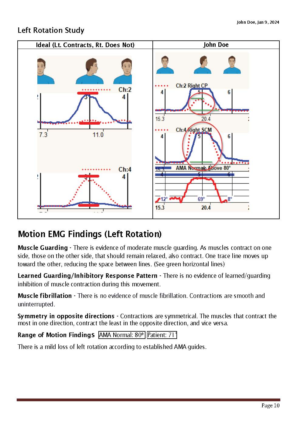 Sample Cervical Dynarom ROM EMG 11-2024_Page_10