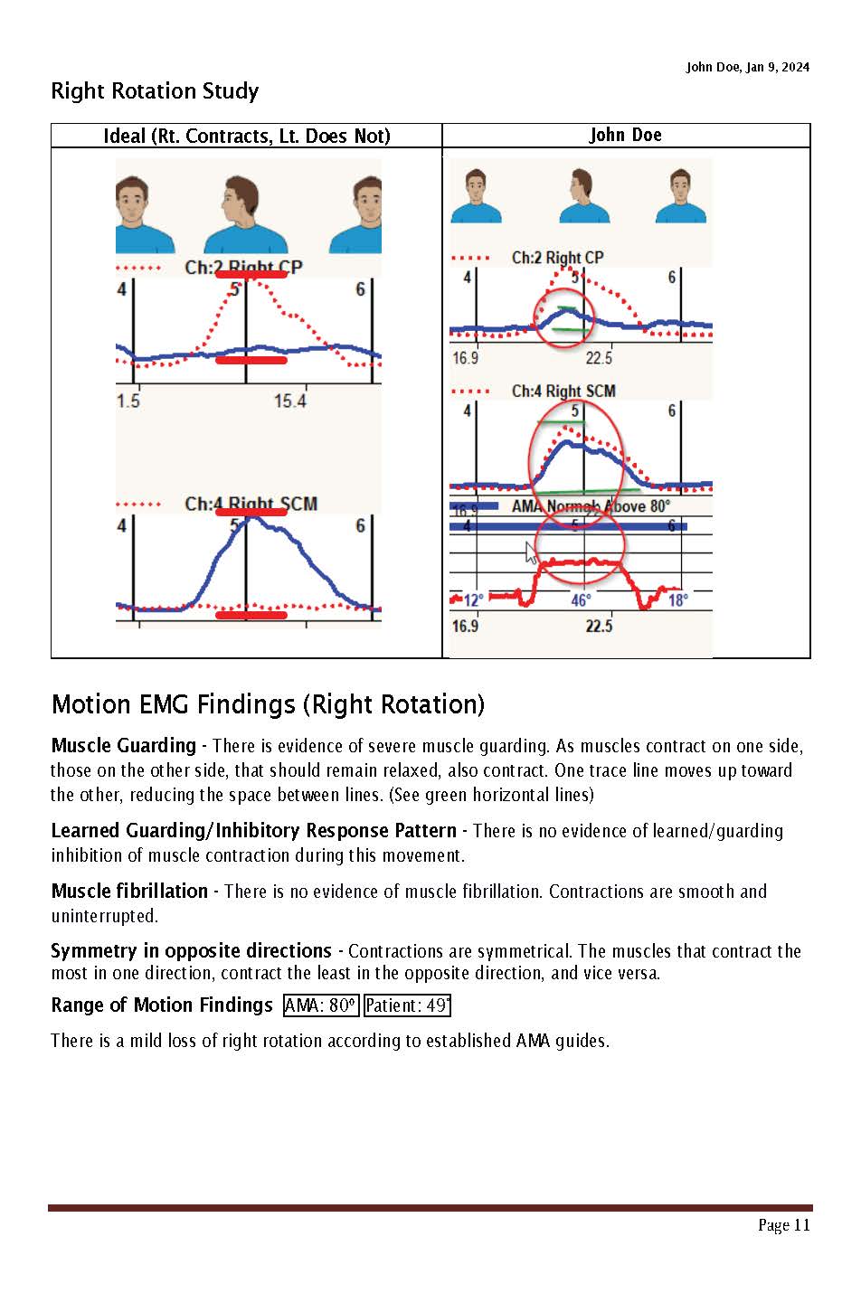 Sample Cervical Dynarom ROM EMG 11-2024_Page_11