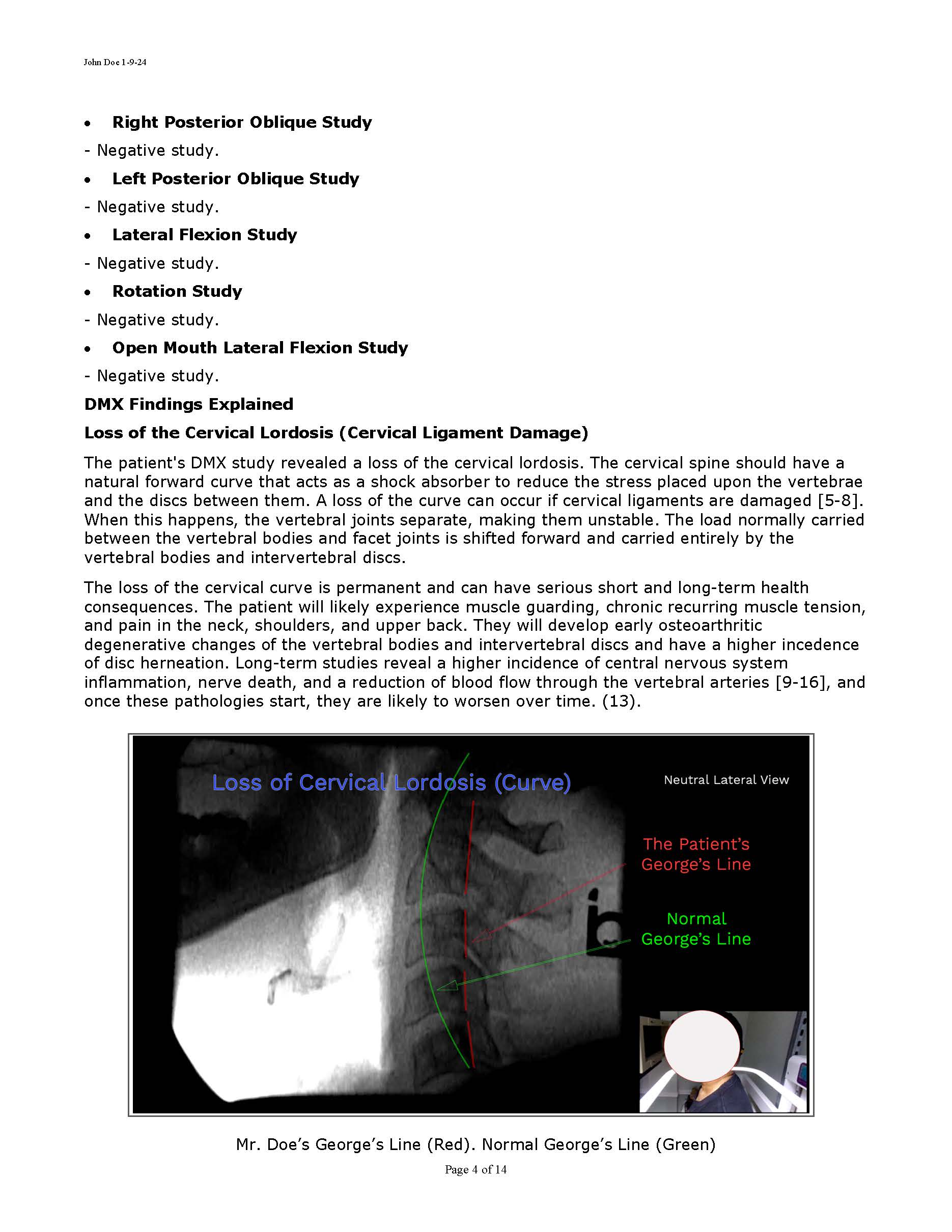 Sample Motion Xray Report 11-2024_Page_04