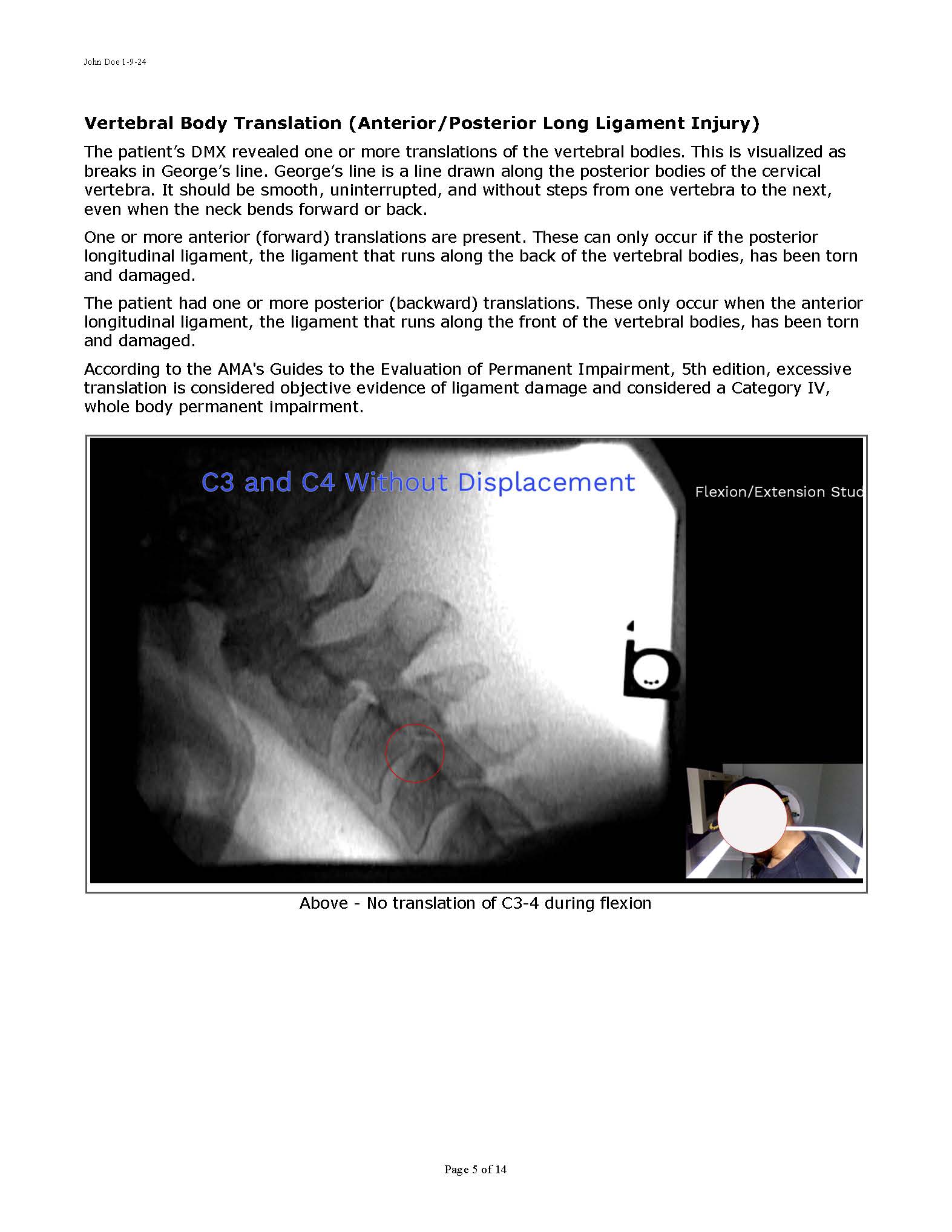 Sample Motion Xray Report 11-2024_Page_05