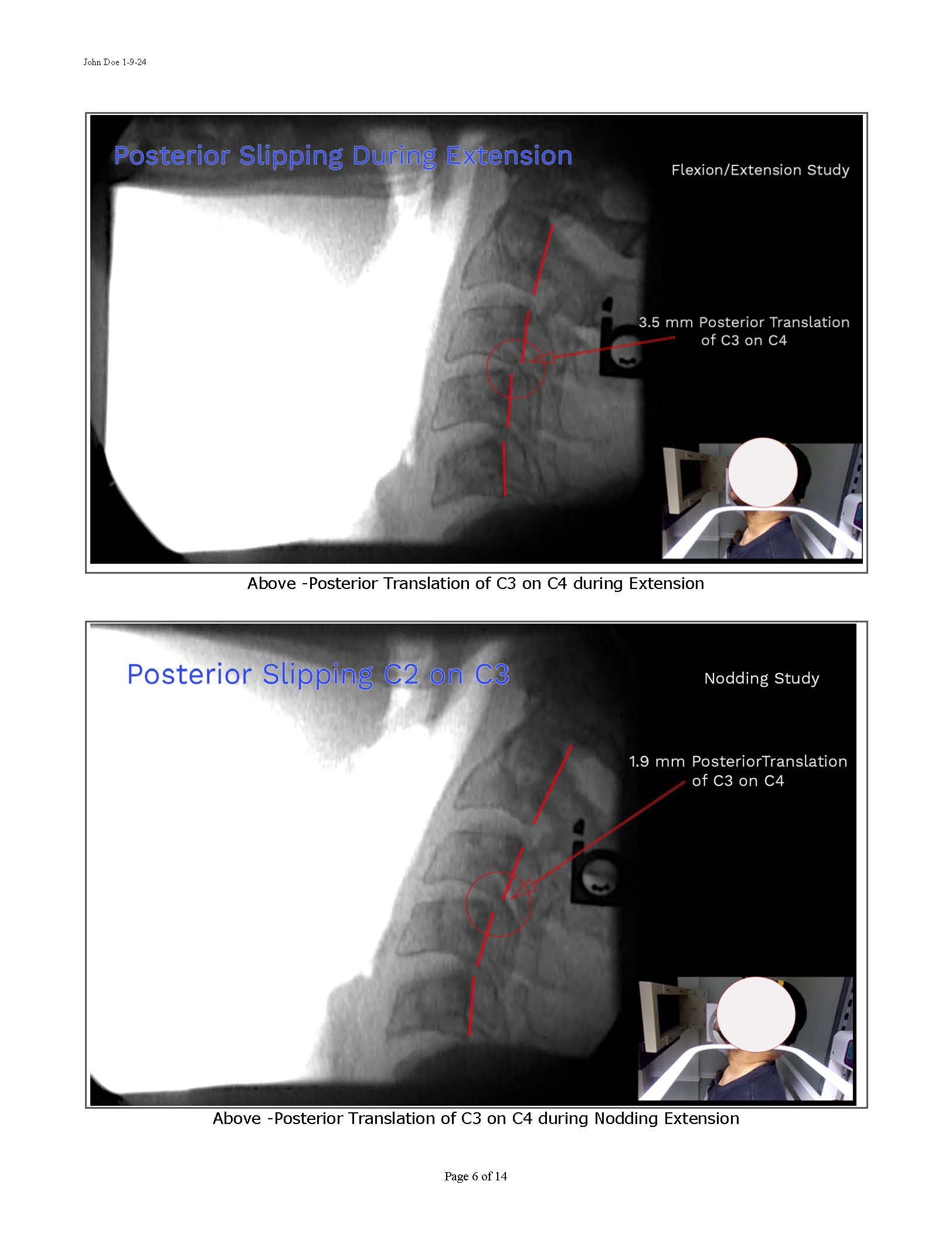 Sample Motion Xray Report 11-2024_Page_06