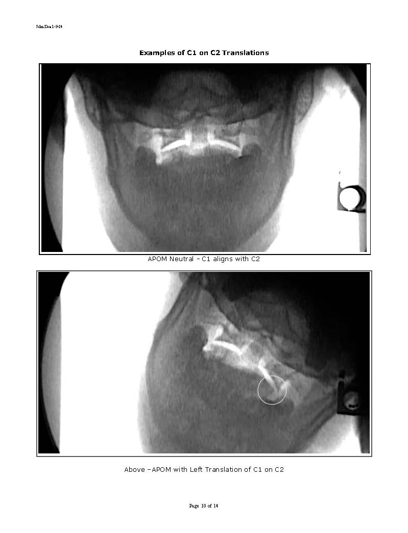 Sample Motion Xray Report 11-2024_Page_10