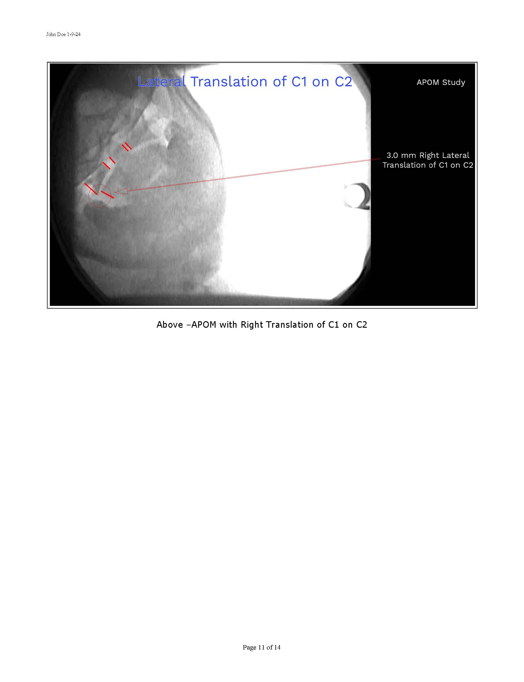 Sample Motion Xray Report 11-2024_Page_11